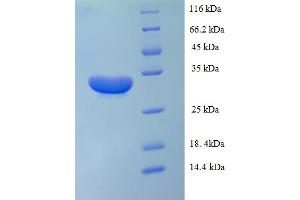 SDS-PAGE (SDS) image for Interleukin 1 alpha (IL1A) (AA 113-271) protein (His-SUMO Tag) (ABIN5709737) (IL1A Protein (AA 113-271) (His-SUMO Tag))