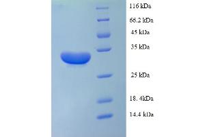 SDS-PAGE (SDS) image for Interleukin 1 alpha (IL1A) (AA 113-271) protein (His-SUMO Tag) (ABIN5709737) (IL1A Protein (AA 113-271) (His-SUMO Tag))