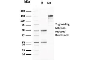 SDS-PAGE Analysis Purified AKT1 Mouse Monoclonal Antibody (AKT1/2784).