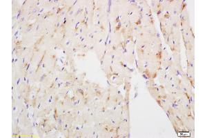 Immunohistochemistry (IHC) image for anti-NADH Dehydrogenase (Ubiquinone) Fe-S Protein 3, 30kDa (NADH-Coenzyme Q Reductase) (NDUFS3) (AA 201-264) antibody (ABIN750673)