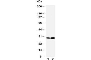 Western blot testing of LASP1 antibody and Lane 1:  HeLa;  2: MCF-7 cell lysate. (LASP1 Antikörper  (C-Term))