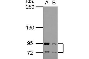 WB Image Sample (30 ug of whole cell lysate) A: Raji B: K562 5% SDS PAGE antibody diluted at 1:1000 (FCAR Antikörper)