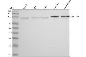 Western blot analysis of TRAF6BP using anti-TRAF6BP antibody (ABIN7606562).