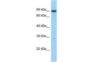 Host: Rabbit Target Name: UTP14C Sample Type: 721_B Whole Cell lysates Antibody Dilution: 1. (UTP14C Antikörper  (C-Term))