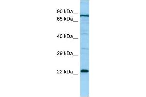 WB Suggested Anti-PTGES2 Antibody Titration: 1. (PTGES2 Antikörper  (Middle Region))