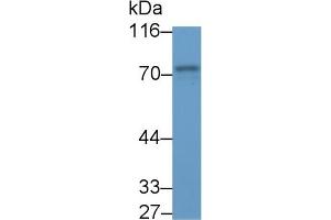 Detection of SYK in Porcine Spleen lysate using Polyclonal Antibody to Spleen Tyrosine Kinase (SYK) (SYK Antikörper  (AA 374-635))