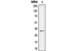 Western blot analysis of MEOX2 expression in HeLa (A) whole cell lysates. (MEOX2 Antikörper  (Center))