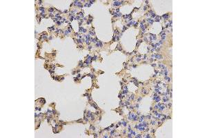 Immunohistochemistry of paraffin-embedded mouse lung using PRKACB antibody. (PRKACB Antikörper  (AA 1-351))