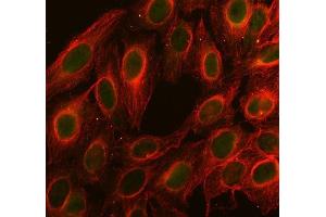 IF analysis of Cdc25C using anti-Cdc25C antibody (ABIN3042352) and anti-Tubulin Alpha antibody (ABIN7600339). (CDC25C Antikörper  (AA 175-473))