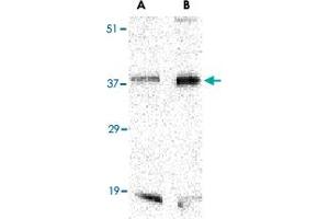 Western blot analysis of BAG1 in PC-3 cell lysate with BAG1 polyclonal antibody  at (A) 1 and (B) 2 ug/mL . (BAG1 Antikörper  (C-Term))