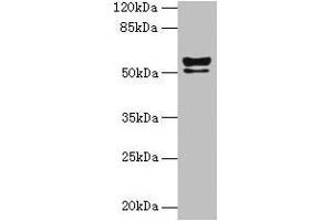 Western blot All lanes: KRT72 antibody at 2 μg/mL + MCF-7 whole cell lysate Secondary Goat polyclonal to rabbit IgG at 1/10000 dilution Predicted band size: 56, 52 kDa Observed band size: 56, 52 kDa (Keratin 72 Antikörper  (AA 301-511))