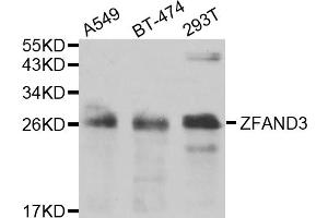 Western blot analysis of extracts of various cell lines, using ZFAND3 antibody (ABIN5975562) at 1/1000 dilution. (ZFAND3 Antikörper)