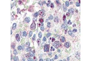 IHC analysis of FFPE human spleen tissue stained with anti-SNAIL antibody