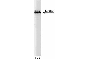 Western blot analysis of Phospholipase Cgamma1 on a A431 cell lysate (Human epithelial carcinoma, ATCC CRL-1555). (Phospholipase C gamma 1 Antikörper  (N-Term))