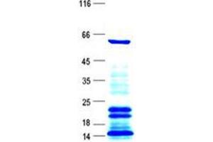 Validation with Western Blot
