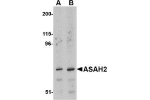 Western Blotting (WB) image for anti-N-Acylsphingosine Amidohydrolase (Non-Lysosomal Ceramidase) 2 (ASAH2) (C-Term) antibody (ABIN1030258) (ASAH2 Antikörper  (C-Term))
