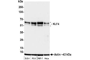 Western Blotting (WB) image for anti-Kruppel-Like Factor 4 (Gut) (KLF4) (AA 75-125) antibody (ABIN7795639)