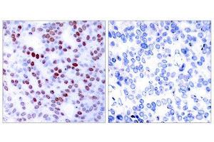 Immunohistochemistry (IHC) image for anti-Jun Proto-Oncogene (JUN) (Ser243) antibody (ABIN1848120) (C-JUN Antikörper  (Ser243))