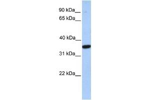 MOGAT1 antibody used at 1 ug/ml to detect target protein. (MOGAT1 Antikörper  (C-Term))
