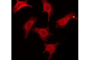 Immunofluorescence (fixed cells) (IF/ICC) image for anti-Connector Enhancer of Kinase Suppressor of Ras 1 (CNKSR1) (Internal Region) antibody (ABIN6257596)