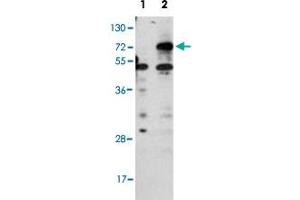 Western blot analysis of CPT1B (arrow) using rabbit CPT1B polyclonal antibody . (CPT1B Antikörper  (C-Term))