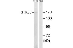 Western blot analysis of extracts from K562 cells, using STK36 antibody. (STK36 Antikörper  (Internal Region))