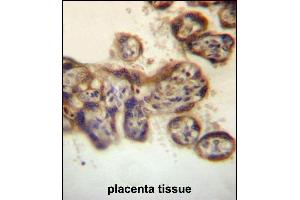 Immunohistochemistry (Paraffin-embedded Sections) (IHC (p)) image for anti-Protein tyrosine Phosphatase, Non-Receptor Type 2 (PTPN2) (AA 329-358), (C-Term) antibody (ABIN657234)