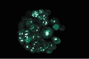 Immunofluorescence staining of WiDr cells (Human colorectal adenocarcinoma, ATCC CCL-218). (RAD23B Antikörper  (AA 73-193))