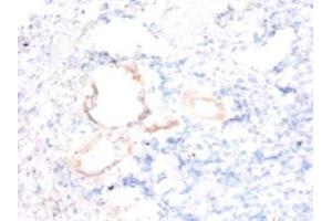Immunohistochemistry of paraffin-embedded human kidney tissue using ABIN7143861 at dilution of 1:50 (Ensa Antikörper  (AA 1-121))