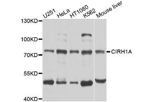 Western blot analysis of extracts of various cell lines, using CIRH1A antibody (ABIN5996208) at 1/1000 dilution. (CIRH1A Antikörper)