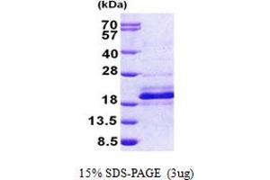 SDS-PAGE (SDS) image for DnaJ (Hsp40) Homolog, Subfamily C, Member 24 (DNAJC24) (AA 1-149) protein (His tag) (ABIN5852986)