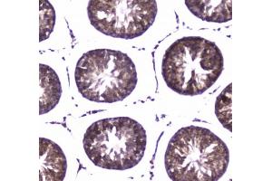 IHC testing of FFPE rat tesis tissue with WWOX antibody at 1ug/ml. (WWOX Antikörper)