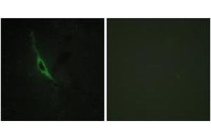 Immunofluorescence analysis of NIH-3T3 cells, using GRAK Antibody. (GZMK Antikörper  (AA 61-110))
