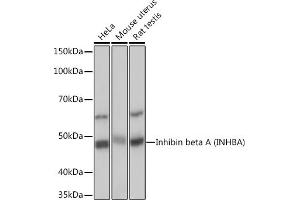 Western blot analysis of extracts of various cell lines, using Inhibin beta A (INHBA) (INHBA) Rabbit mAb (ABIN7267870) at 1:1000 dilution. (INHBA Antikörper)
