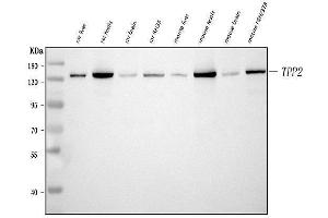 Western blot analysis of Tripeptidyl peptidase II/TPPII/TPP2 using anti-Tripeptidyl peptidase II/TPPII/TPP2 antibody (ABIN7601293). (Tpp2 Antikörper  (AA 32-1001))