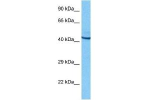 Host:  Rat  Target Name:  POU2F3  Sample Tissue:  Rat Brain  Antibody Dilution:  1ug/ml (POU2F3 Antikörper  (N-Term))