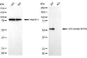 Western blotting analysis using p53 (acetyl K370) antibody (ABIN7800682). (Rekombinanter p53 Antikörper  (acLys370))