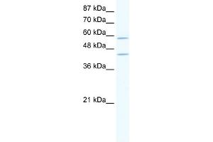 WB Suggested Anti-DCP1A Antibody Titration:  2. (DCP1A Antikörper  (N-Term))