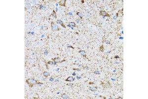 Immunohistochemistry (Paraffin-embedded Sections) (IHC (p)) image for anti-Heat Shock 70kDa Protein 9 (Mortalin) (HSPA9) (AA 380-679) antibody (ABIN3021000)
