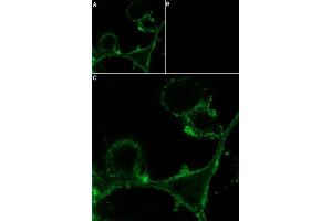 Unlabeled α-Bungarotoxin successfully blocks nicotinic ACh channels access. (alpha-Bungarotoxin protein (Atto 550))