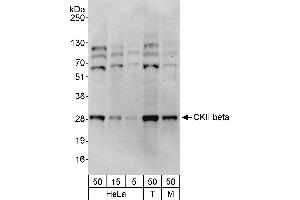 Western Blotting (WB) image for anti-Casein Kinase 2, beta (CSNK2B) (AA 100-150) antibody (ABIN7454541)
