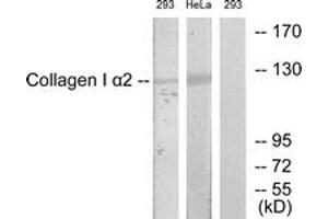 Western Blotting (WB) image for anti-Collagen, Type I, alpha 2 (COL1A2) (AA 471-520) antibody (ABIN2879172) (COL1A2 Antikörper  (AA 471-520))