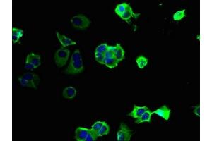 Immunofluorescent analysis of MCF-7 cells using ABIN7163824 at dilution of 1:100 and Alexa Fluor 488-congugated AffiniPure Goat Anti-Rabbit IgG(H+L) (PKD1L2 Antikörper  (AA 1-306))