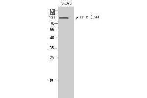 Western Blotting (WB) image for anti-Eukaryotic Translation Elongation Factor 2 (EEF2) (pThr56) antibody (ABIN3182747) (EEF2 Antikörper  (pThr56))