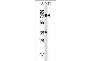 PLS1 Antibody (C-term) (ABIN657071 and ABIN2846234) western blot analysis in Jurkat cell line lysates (35 μg/lane).