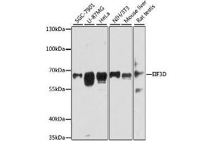 Western blot analysis of extracts of various cell lines, using EIF3D antibody. (EIF3D Antikörper  (AA 1-240))