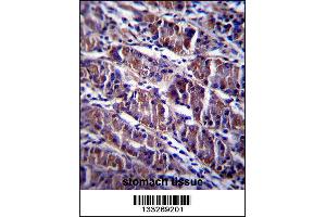 HDAC7 Antibody immunohistochemistry analysis in formalin fixed and paraffin embedded human stomach tissue followed by peroxidase conjugation of the secondary antibody and DAB staining. (HDAC7 Antikörper  (C-Term))