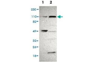 Western Blot analysis of (1) Human RT-4 cell, (2) Human U-251MG sp cell. (PAX3 and PAX7 Binding Protein 1 (PAXBP1) Antikörper)