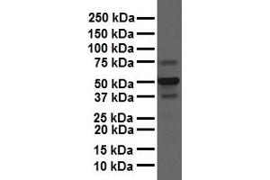 WB Suggested Anti-CSF1 antibody Titration: 1 ug/mL Sample Type: Human liver (M-CSF/CSF1 Antikörper  (N-Term))