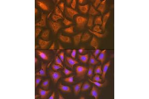 Immunofluorescence analysis of U-2 OS cells using U Rabbit mAb (ABIN7271211) at dilution of 1:100 (40x lens). (UAP1 Antikörper)